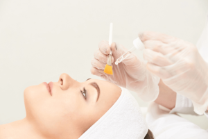 peeling chemiczny-2